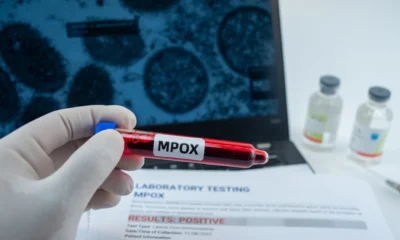 mpox-virus.jpg