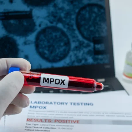 mpox-virus.jpg