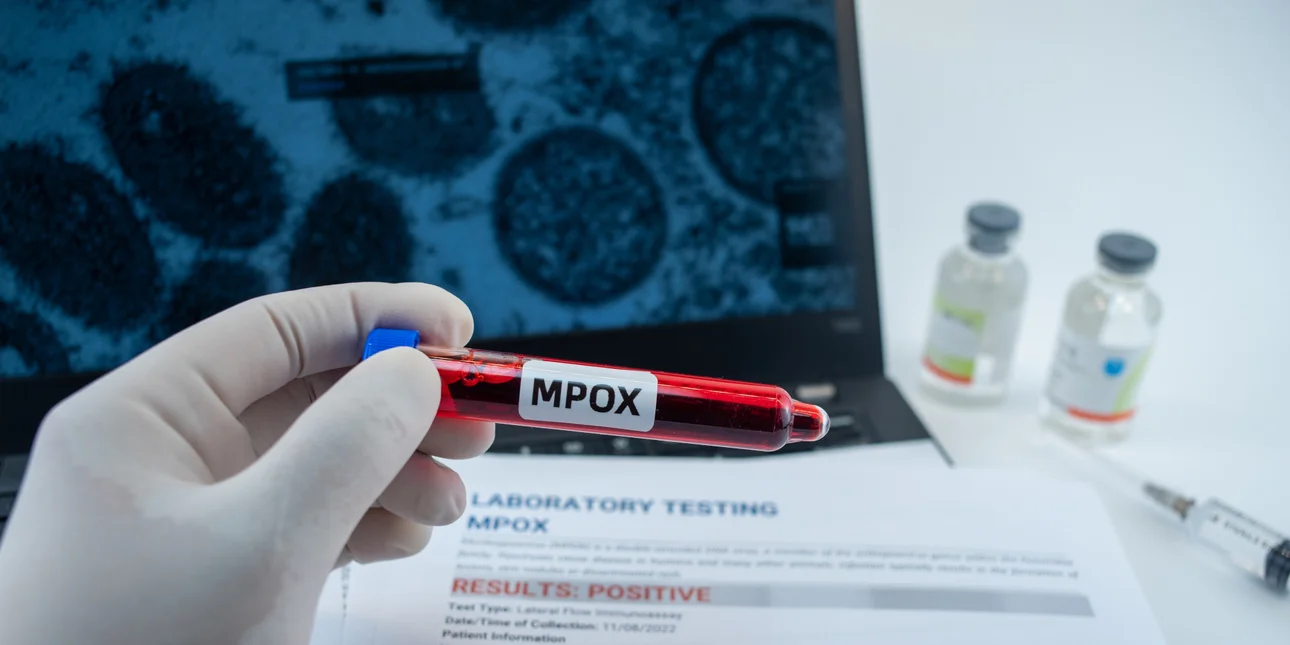 mpox-virus.jpg